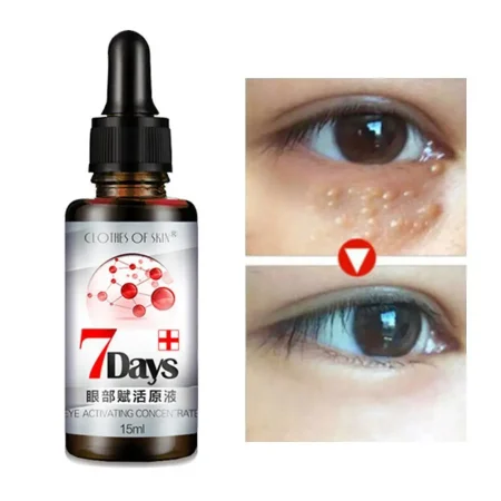 Instant Remove Fat-removing Eye Cream 7 Days Remove Eye Bags And Care Fat Eye Puffiness Particles Skin Anti Anti Serum Cream