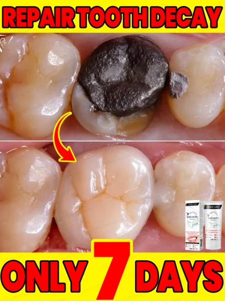 Anti Cavity Whitening Toothpaste to Clean Oral Cavity and Repair Tooth Enamel Dental Caries Decay Prevent for Children Adults