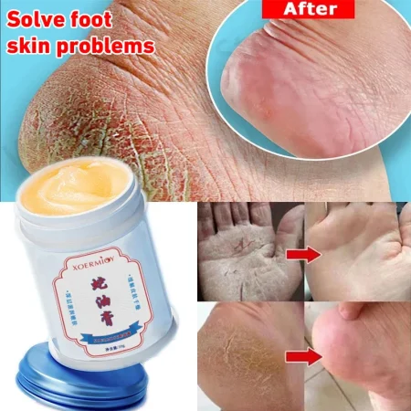 New Anti-Drying Crack Foot Cream Hand Feet Care For Family Exfoliation Dead Skin Removal Softening Moisturize Smooth Skin